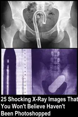 25 Shocking X-Ray Images That You Won't Believe Haven't Been Photoshopped