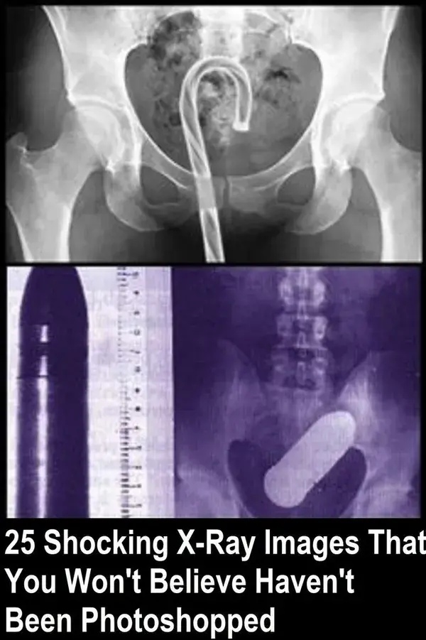 25 Shocking X-Ray Images That You Won't Believe Haven't Been Photoshopped