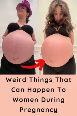 Weird Things That Can Happen To Women During Pregnancy