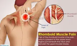 sudden upper back pain