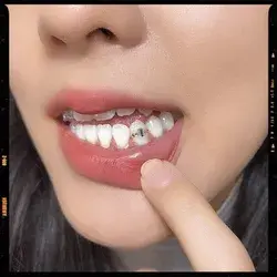 Tooth Piercing