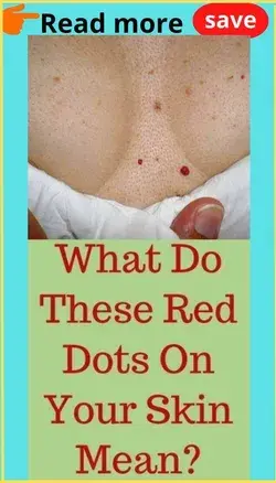 What do these red dots on your skin mean?