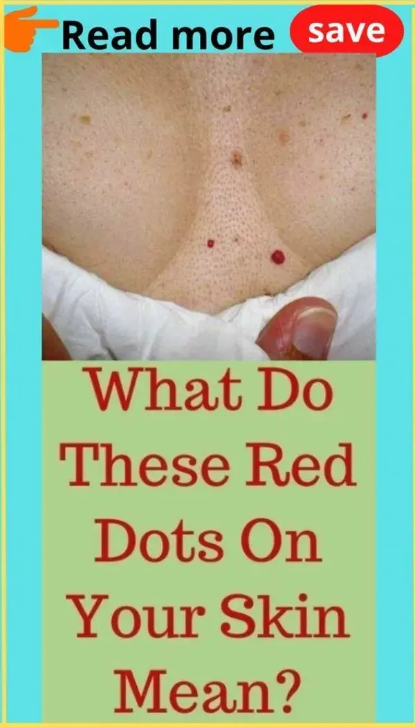 What do these red dots on your skin mean?