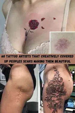 60 tattoo artists that creatively covered up peoples scars making them beautiful