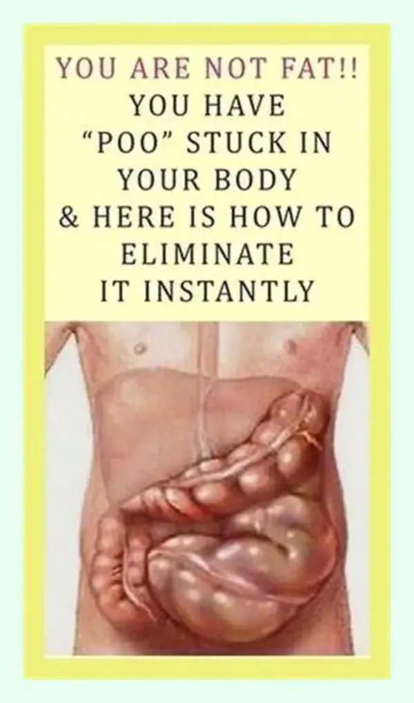 YOU ARE NOT FAT!! YOU HAVE “POO” STUCK IN YOUR BODY & HERE IS HOW TO ELIMINATE IT INSTANTLY