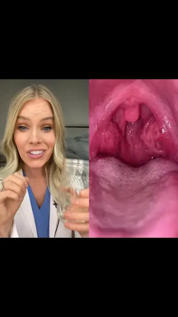 JUICY tonsil stones!