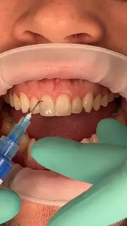 Calgary Dentist | Smile 32 Dentistry