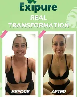 Real Transformation of EXIPURE. Support Healthy Weight Loss