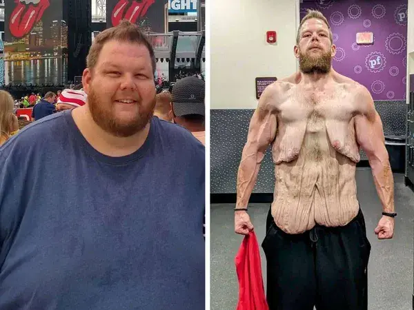 Man’s Incredible 336 Pound Weight Loss Breaks the Internet with Inspiring Results