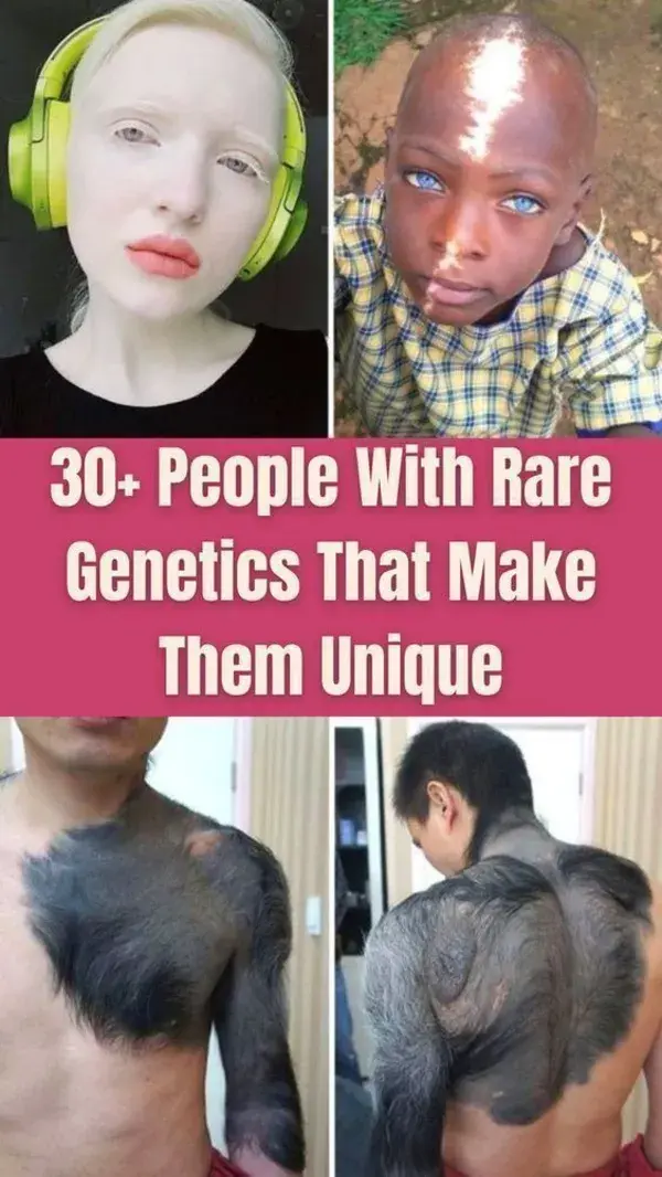 People With Rare Features That Make Them Unique