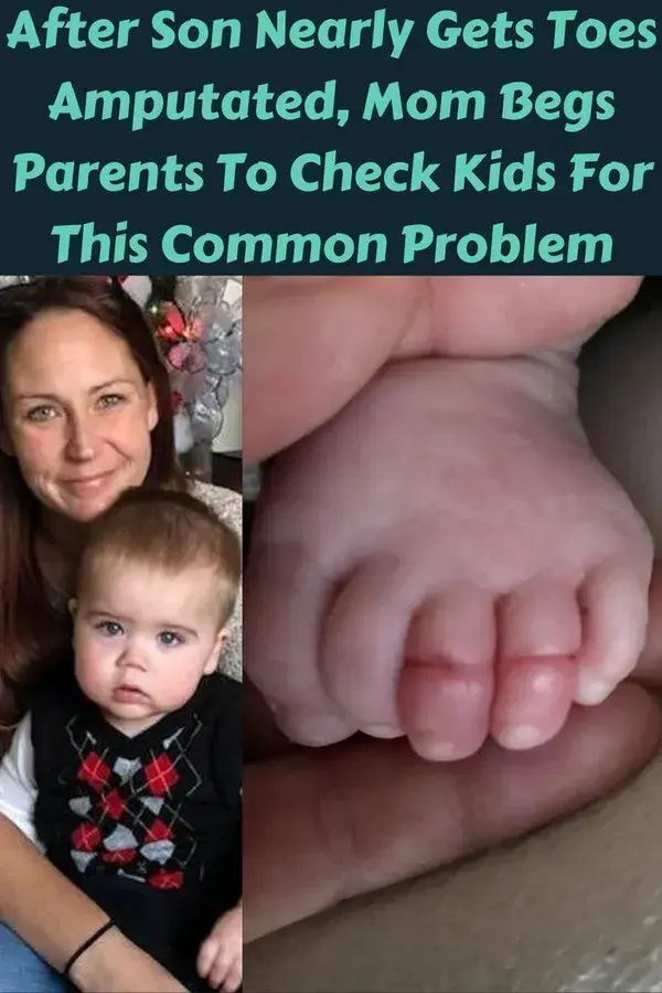 After Son Nearly Gets Toes Amputated, Mom Begs Parents To Check Kids For This Common Problem