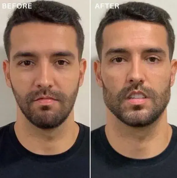 YOU CAN CHANGE THE SHAPE OF YOUR FACE