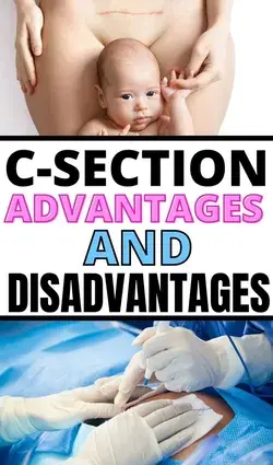 C-Section vs Natural Birth: pros and cons of a scheduled cesarean section