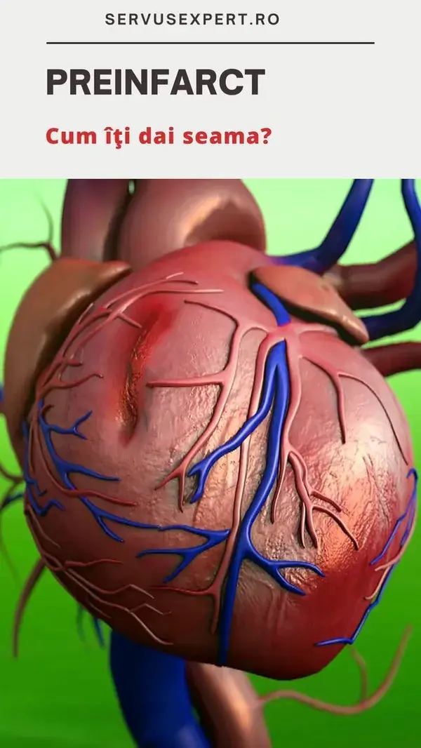 Preinfarct sau infarct miocardic silentios: cum iti dai seama?