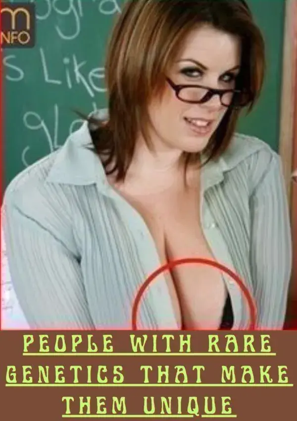 People With Rare Features That Make Them Unique