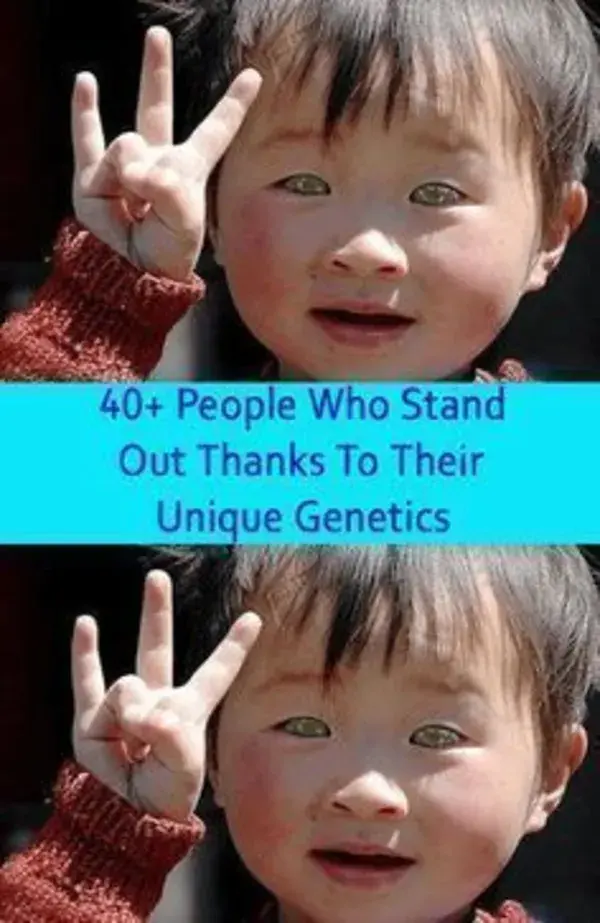 40 people who stand out thanks to their unique genetics