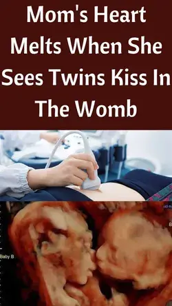 Mom's Heart Melts When She Sees Twins Kiss In The Womb