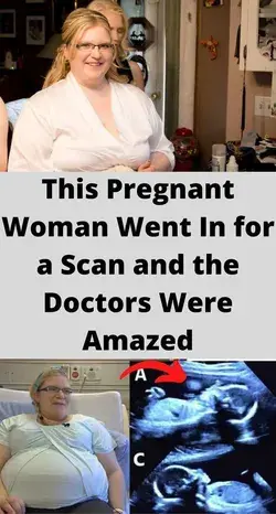 This Pregnant Woman Went In for a Scan and the Doctors Were Amazed