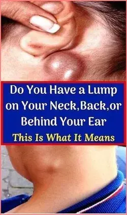 DO YOU HAVE A LUMP ON YOUR NECK, BACK OR BEHIND YOUR EAR? HERE�S WHAT YOU NEED TO KNOW