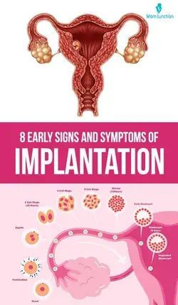 8 Early Signs And Symptoms Of Pregnancy Implantation