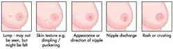 HOW TO PREVENT YOUR BREASTS SAGGING AFTER BREASTFEEDING