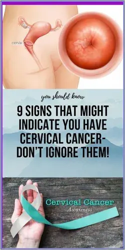 9 Signs That Might Indicate You Have Cervical Cancer