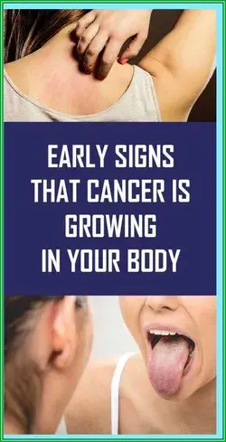 Early Signs That Cancer Is Growing In Your Body