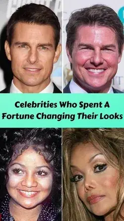 Celebrities Who Spent A Fortune Changing Their Looks