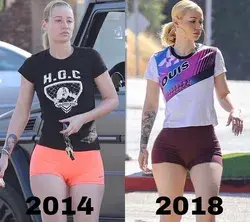 Before and After Photos Of Iggy Azalea - Best Photos