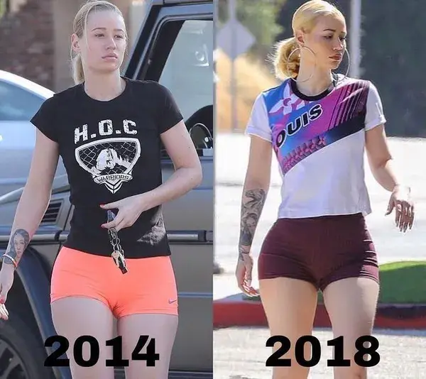 Before and After Photos Of Iggy Azalea - Best Photos