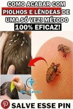 Remédio Caseiro Para Remover Piolhos e Lêndeas!