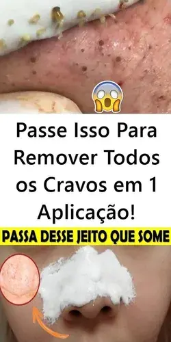 Passe Isso Para Remover Todos os Cravos na Primeira Aplicação!