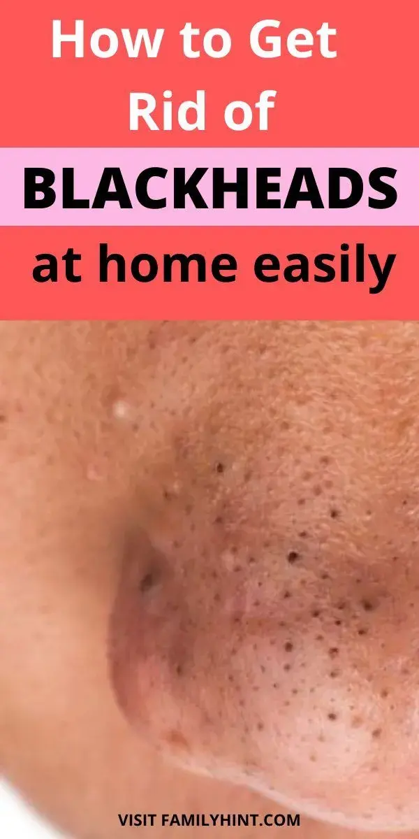 How to Get Rid of Blackheads on Nose At Home