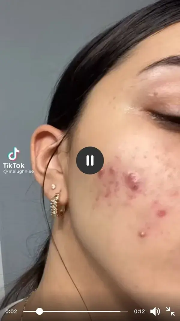 Skin transformation