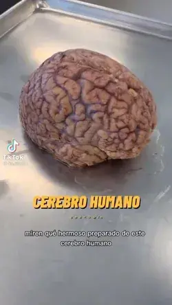 el cerebro humano 🧠