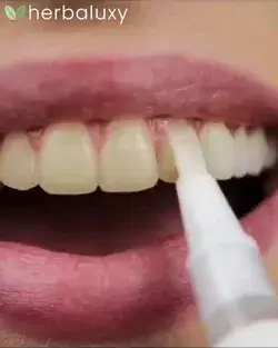 Perfect teeth wightening