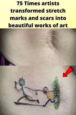 75 Times artists transformed stretch marks and scars into beautiful works of art