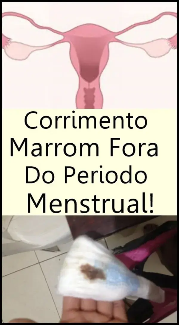 Notou Corrimento Marrom? Veja o que Pode ser e o que Fazer