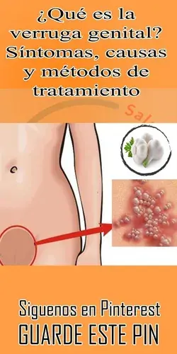 Verrugas en el cuello: ¿Qué son y cómo eliminarlas?