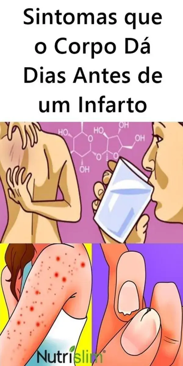 Sintomas que o Corpo Dá Dias Antes de um Infarto