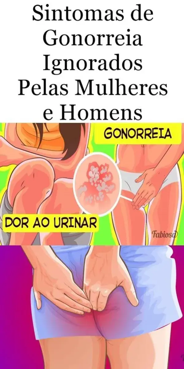 Sintomas de Gonorreia Ignorados Pelas Mulheres e Homens