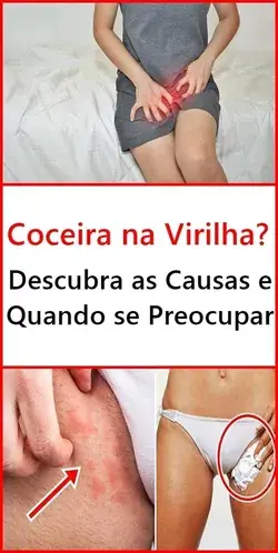 Coceira na Virilha? Descubra as Causas e Quando se Preocupar!