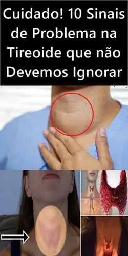 Cuidado! 10 Sinais de Problema na Tireoide que não Devemos Ignorar!