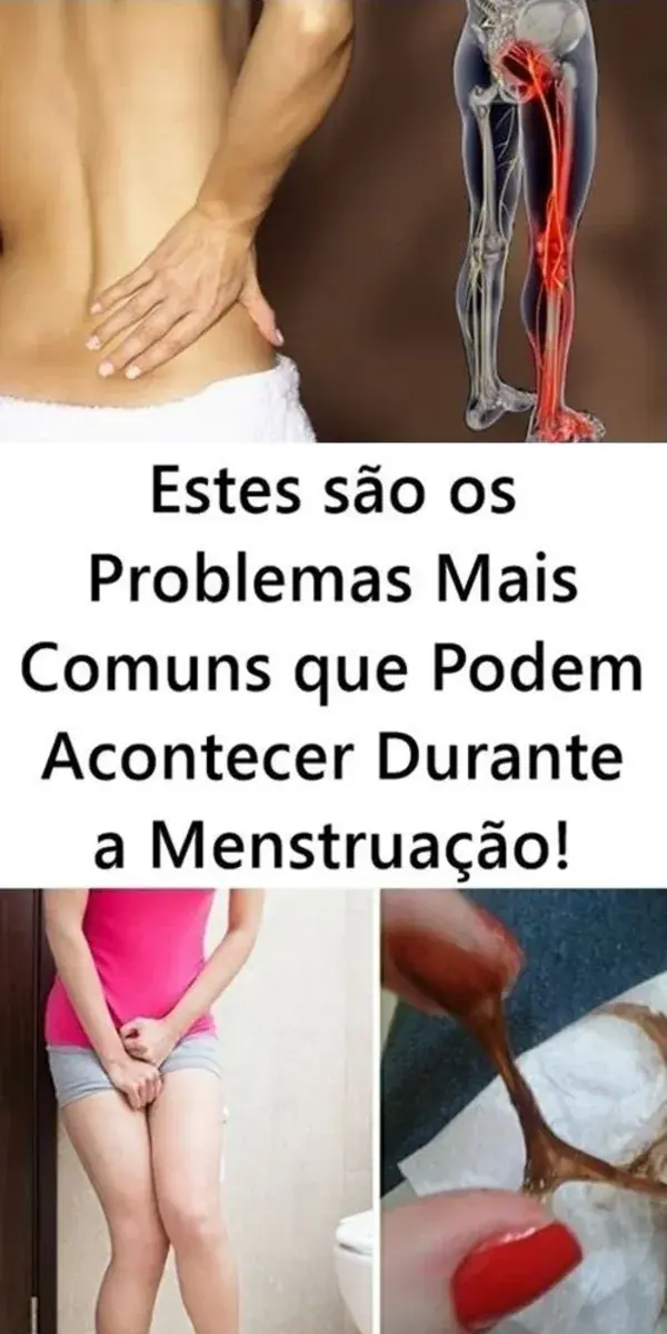 Estes são os Problemas Mais Comuns que Podem Acontecer Durante a Menstruação!