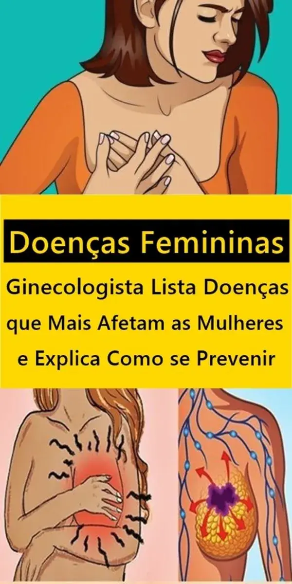 Doenças Femininas! Ginecologista Lista Doenças que Mais Afetam as Mulheres