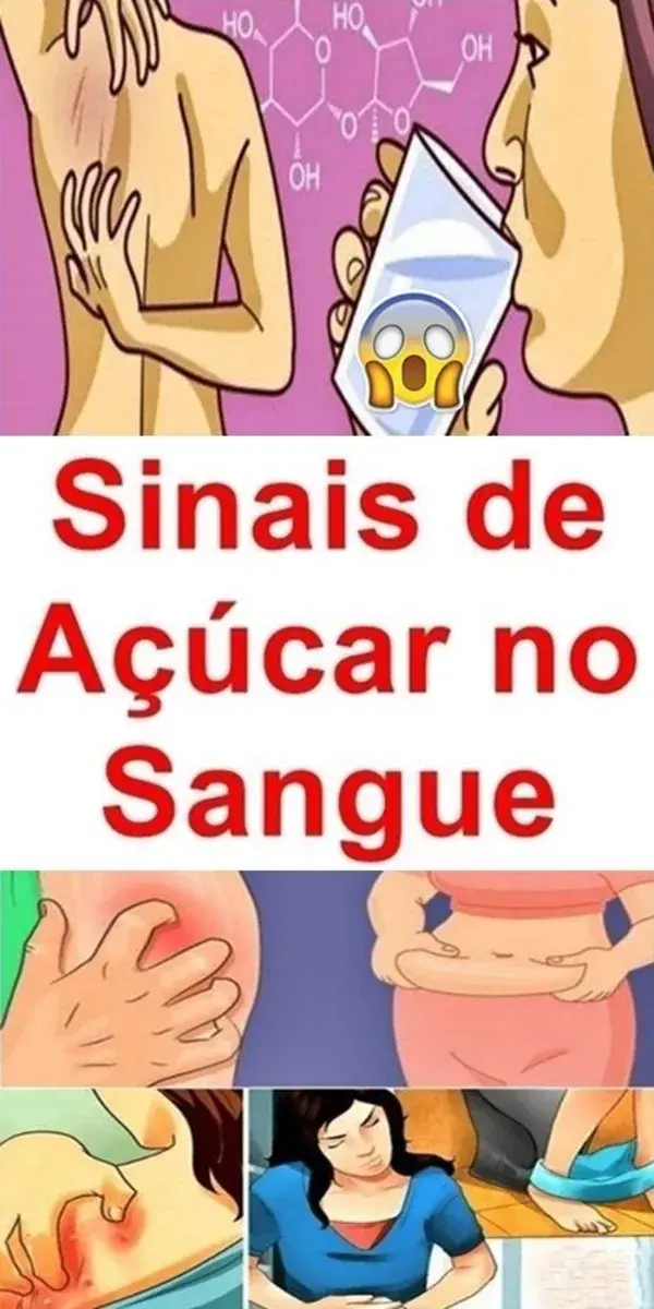 Sinais de Açúcar no Sangue