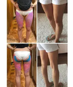 eliminar celulitis de las piernas y glúteos rápido