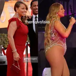 Mariah Carey: Butt Injections Before & After