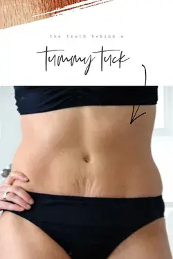 The truth behind a tummy tuck