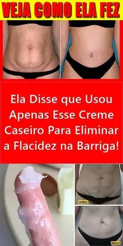 Ela Disse que Usou Apenas Esse Creme Caseiro Para Eliminar a Flacidez na Barriga!